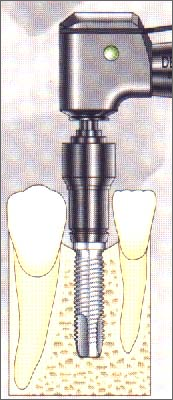 Tosciri Antonio odontoiatra dentista Piacenza