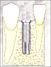 Tosciri Antonio odontoiatra dentista Piacenza
