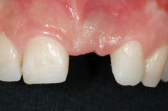 Tosciri Antonio odontoiatra dentista Piacenza