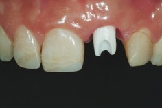 Tosciri Antonio odontoiatra dentista Piacenza