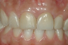 Tosciri Antonio odontoiatra dentista Piacenza