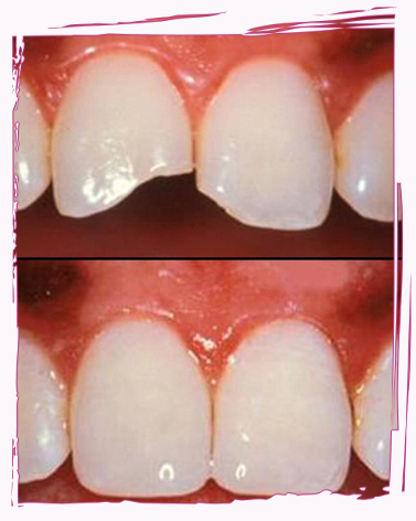 Dott. Antonio Tosciri Dottore Piacenza dentista Tosciri Antonio Antonio Tosciri tosciri antonio odontoiatra odontoiatria chirurgia pedodonzia ortodonzia denti otturazioni estetica protesi convenzioni bambini dentiere cura